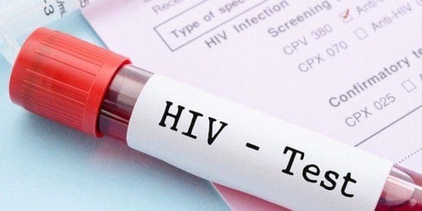 Good HIV news