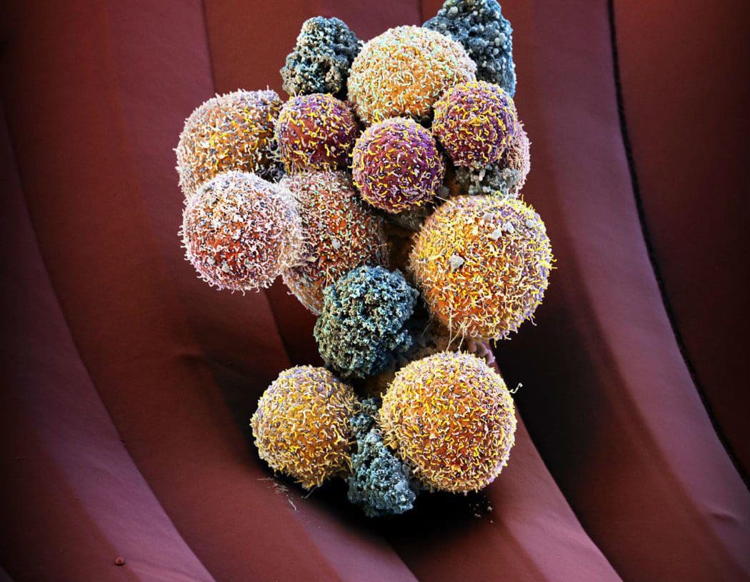 生物学的汚染:その概要、種類、例 - 生物学的汚染の種類