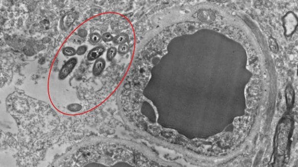 Les tests du microbiome cérébral