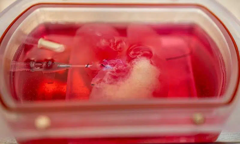 Human liver