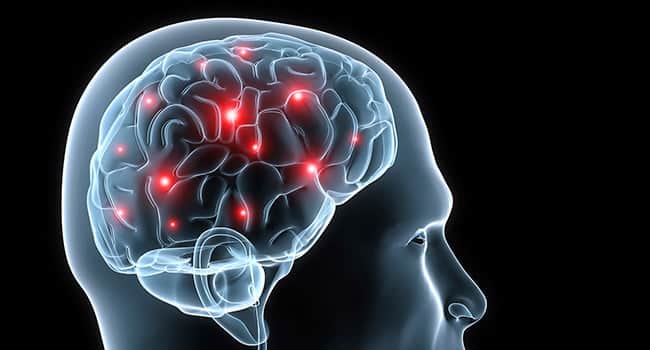 650x350 epilepsy increases migraines 01082013xml