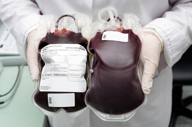 Sangue giovane, trasfusioni