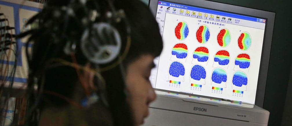 Epilepsy and epileptic attacks