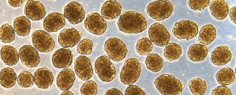 科学者はヒトの細胞を使ってマウスの知能を向上させる