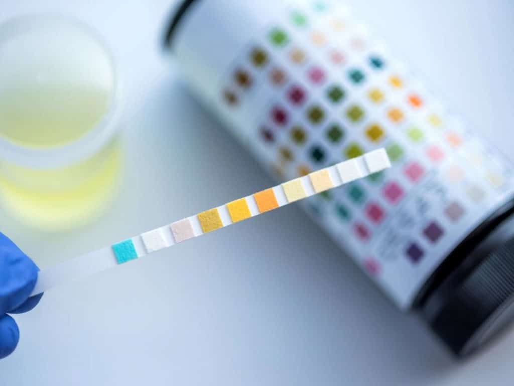 Urinalysis: what is it for and what does it reveal 1200 900