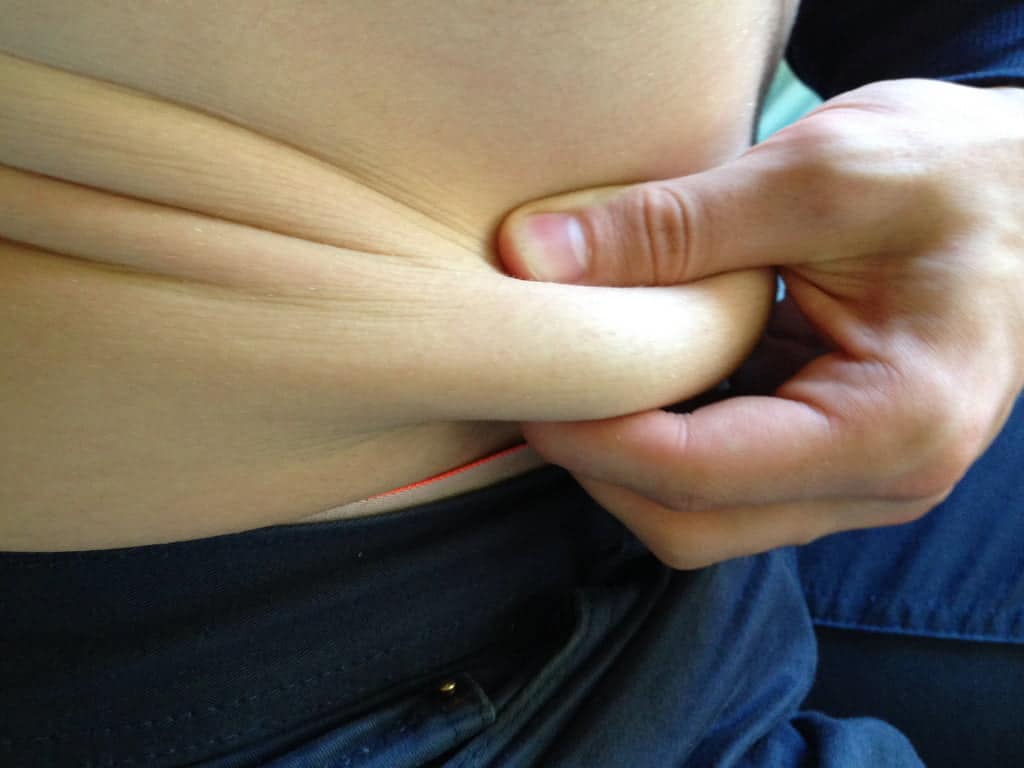 gordura abdominal