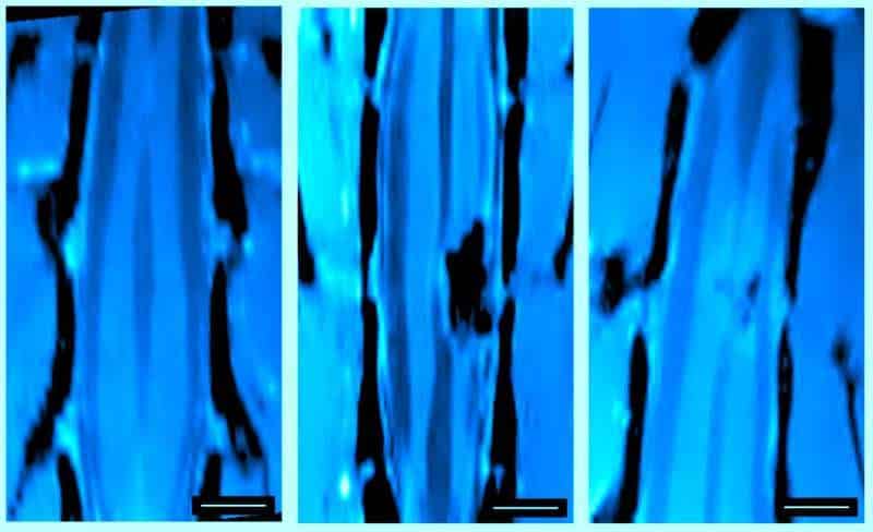 Repair spinal cord injuries with nanomaterials