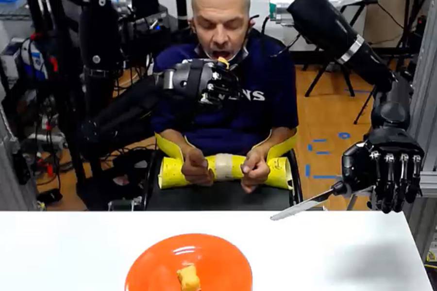 buz prosthetic arms impact