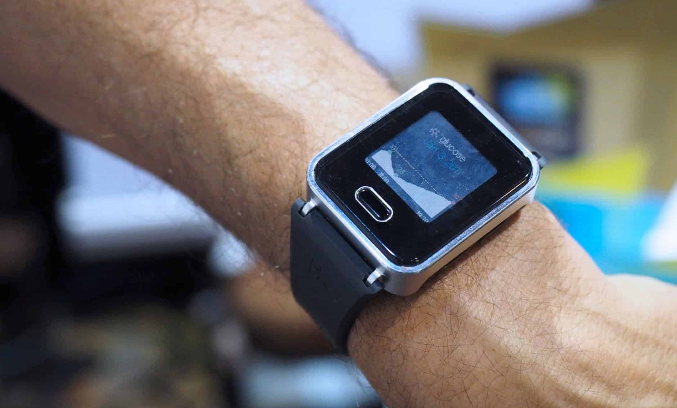 CES2021, ecco lo smartwatch che può misurare la glicemia senza aghi