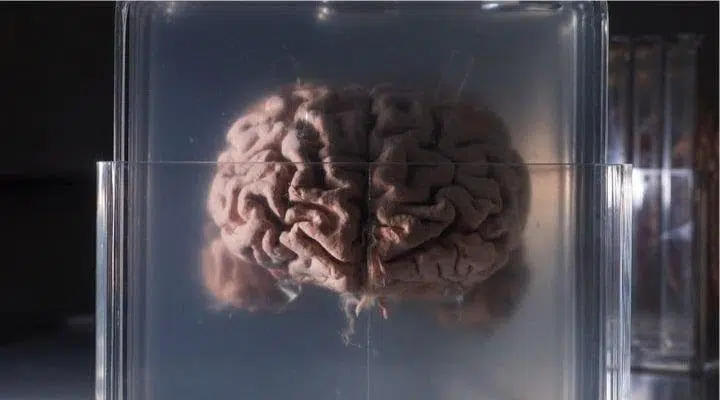 Conservar y digitalizar el nectoma cerebral