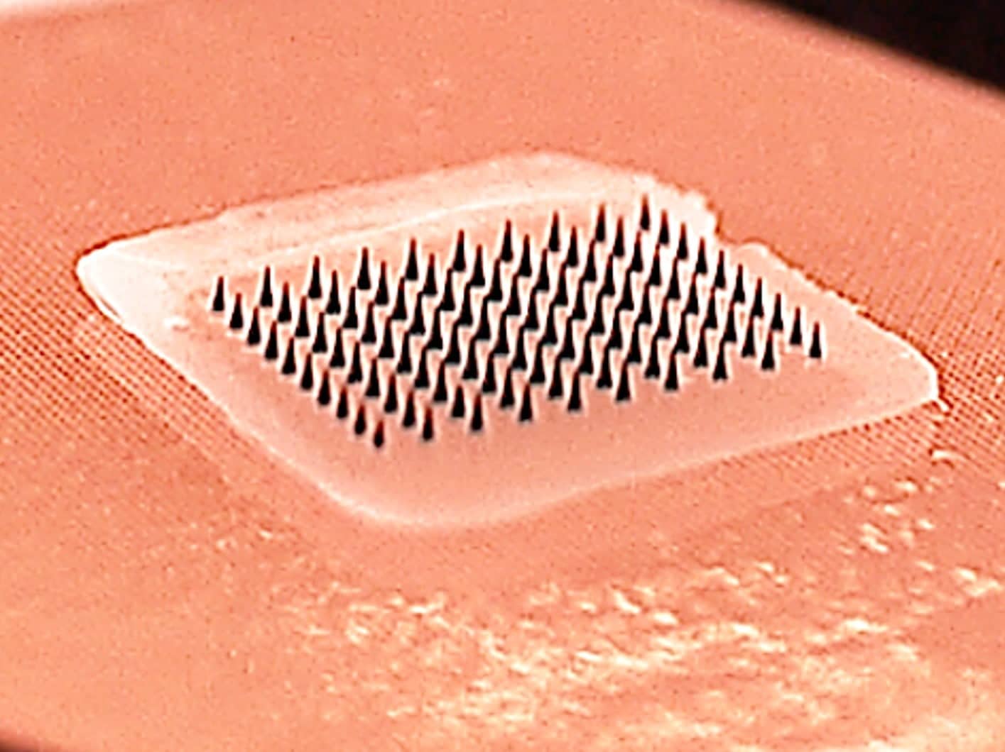 Microneedles closeup