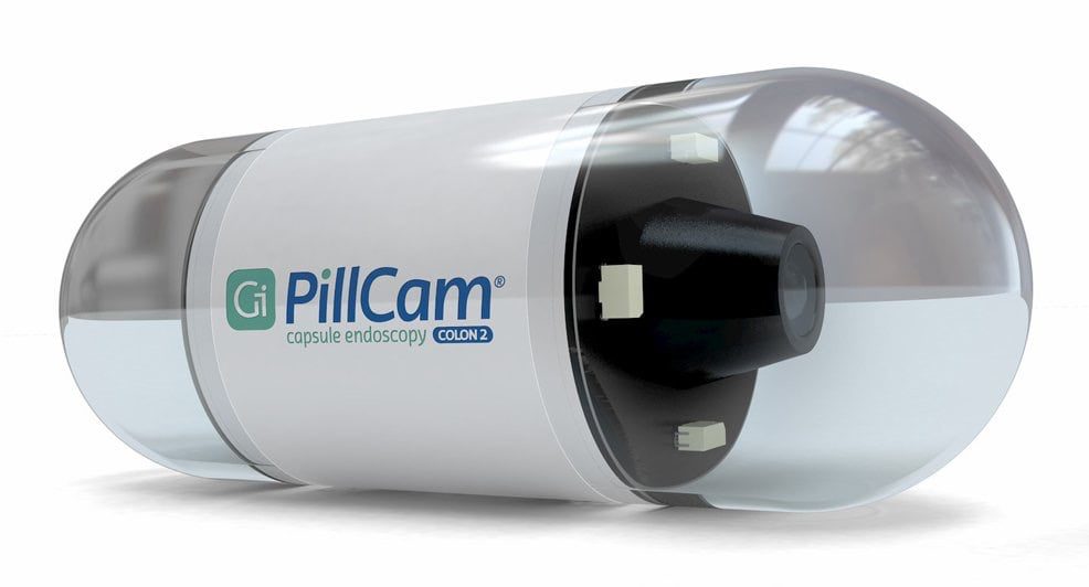 結腸内視鏡検査を受ける必要があるのは誰ですか?