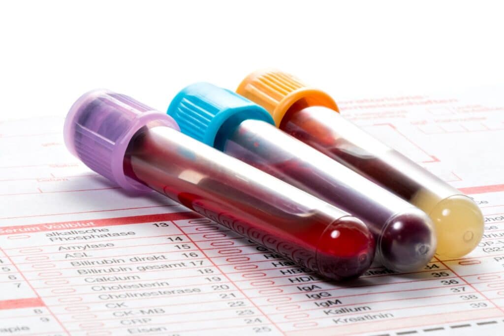 Blood test