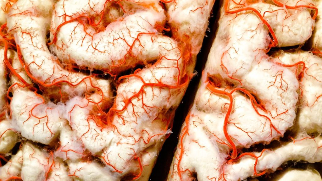1629388651 5 Min. Gesundheit Gehirntumor – und tödlich – zuerst in 3D gedruckt siehe 1024x576 1