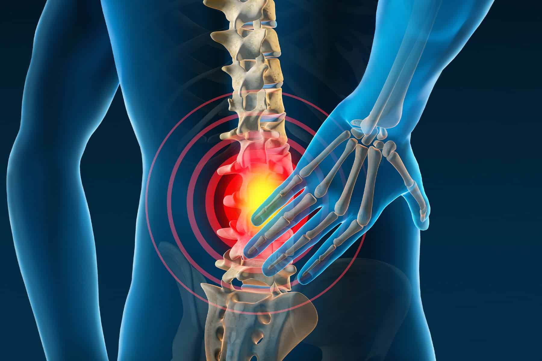 medicamentos senolíticos para el dolor de espalda