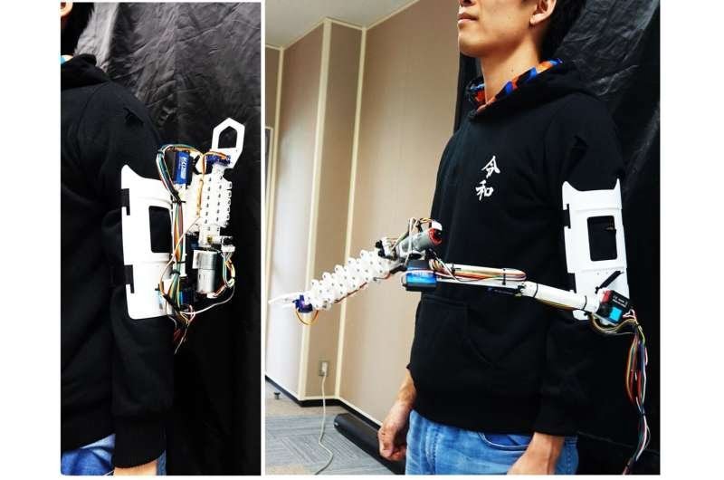 Robotic limb