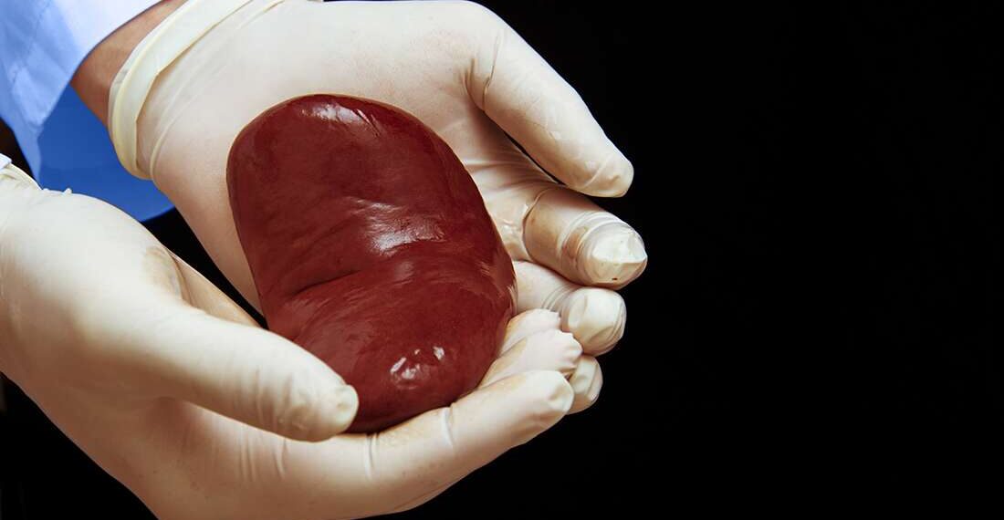 pig kidney transplanted to humans