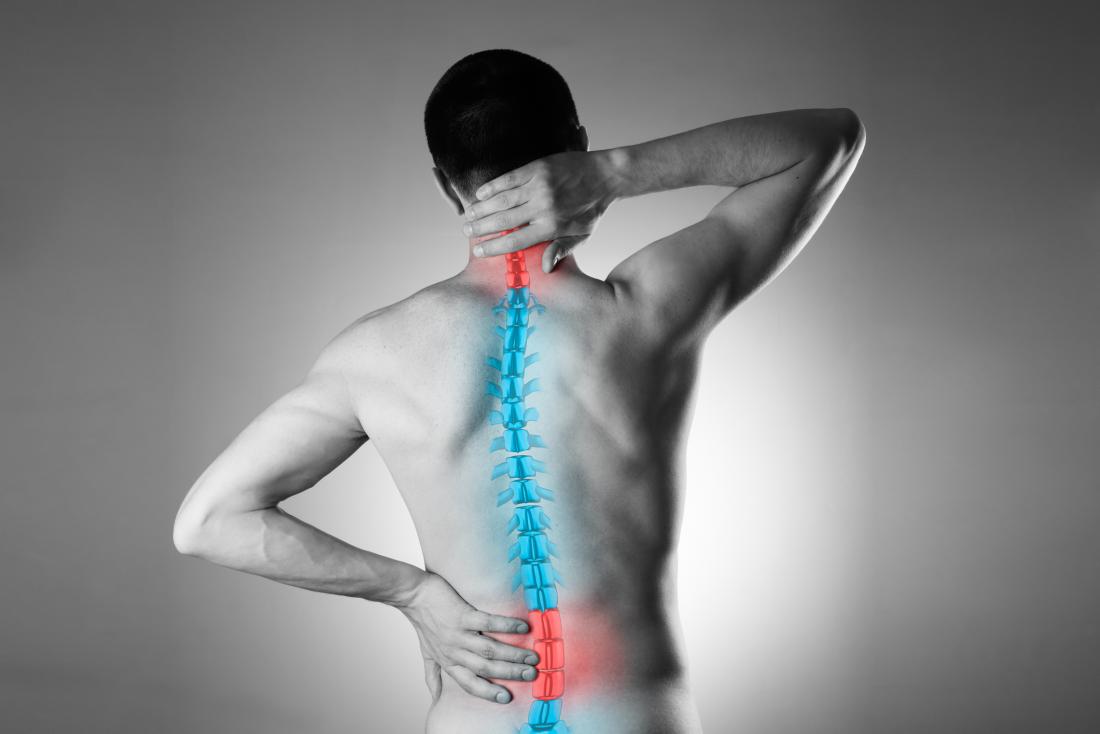 Ilustración de la columna vertebral de un hombre con dolor de espalda