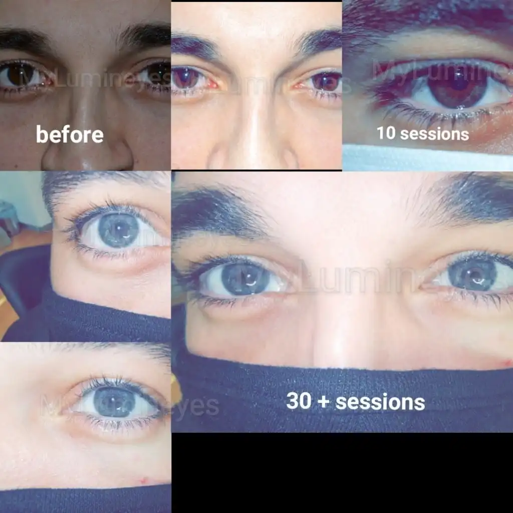 Lumineyes