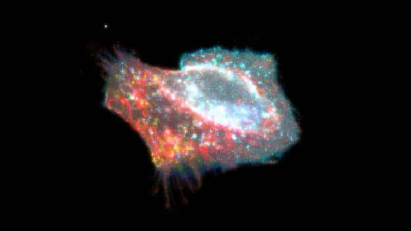Cell death and pyrotosis