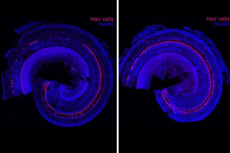 Hair Cells Nuclei Cellular Regeneration 777x518 1