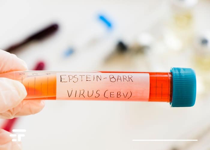 Virus di Epstein Barr