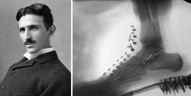 Nikola Tesla Röntgen 0