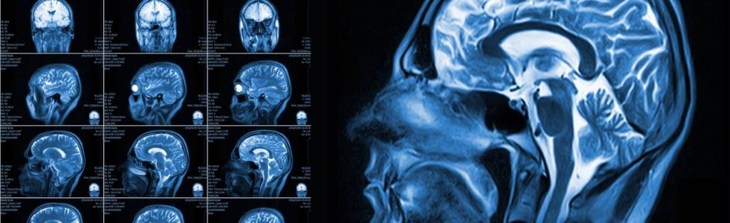 Systèmes médicaux d'intelligence artificielle
