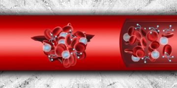 Emorragia interna