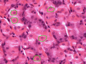 Gastric glands parietal cells 300x225 1