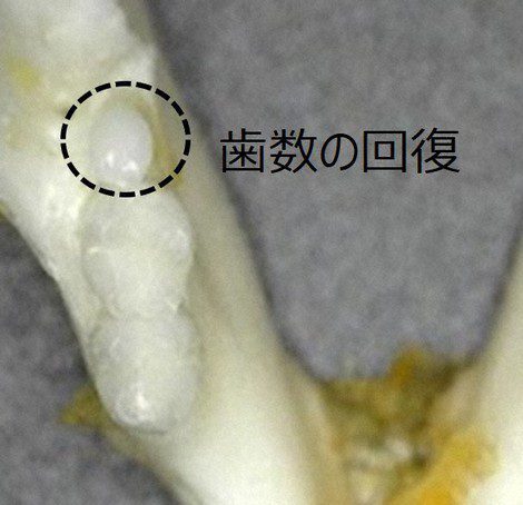 Denti
