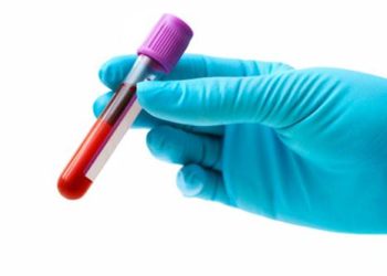 blood sample