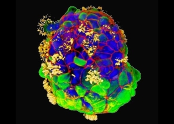 Menschliche Zellen organisieren sich selbst zu vielzelligen, mobilen Organoiden, sogenannten Anthrobots. Dieses Bild zeigt einen Anthrobot mit „Wimpern“ auf seiner Oberfläche.