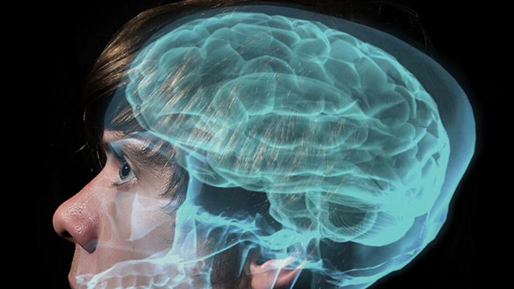 Neuromorfico