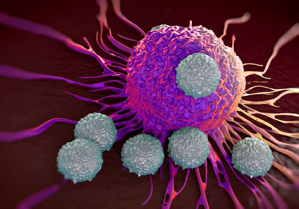 leucemia mieloide