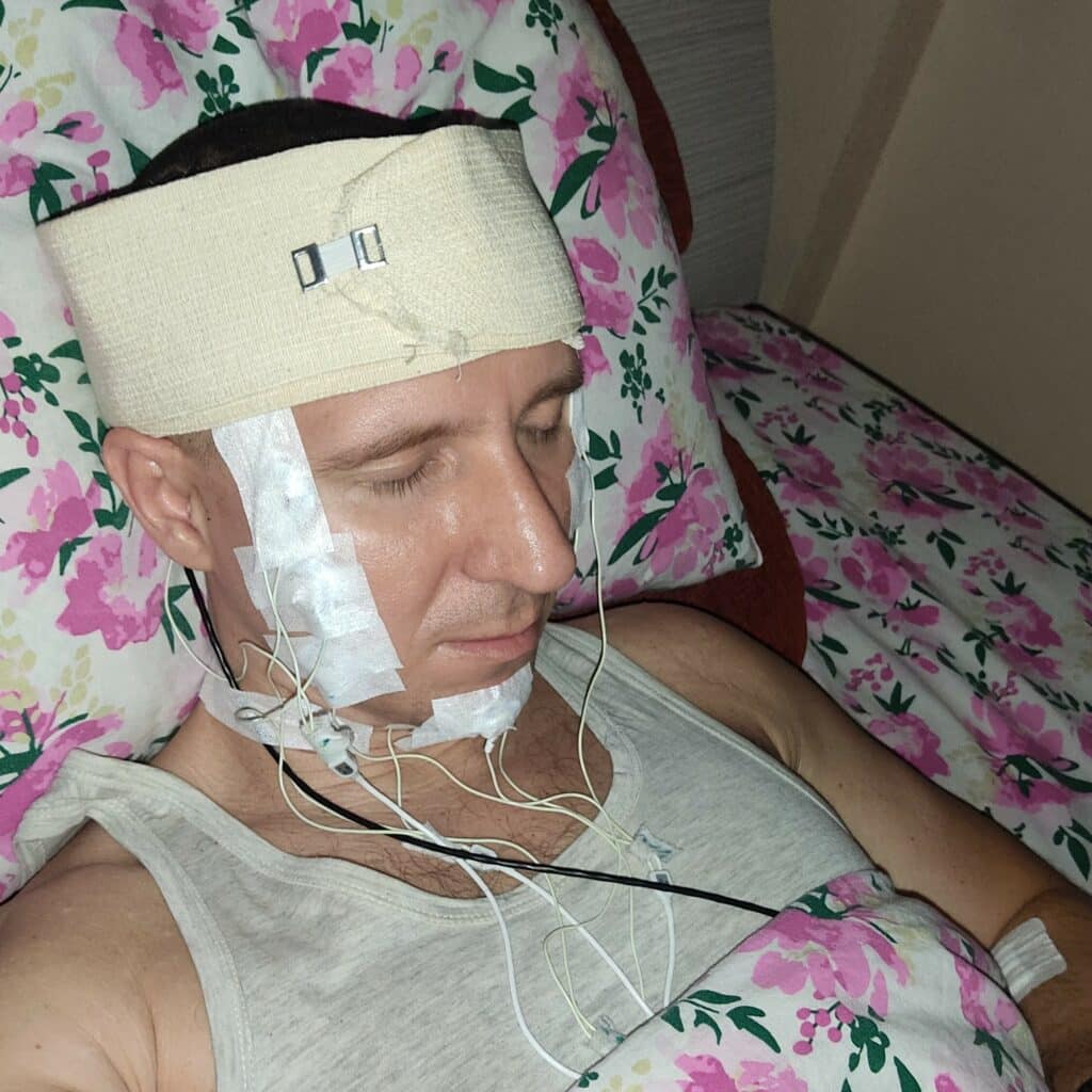 Autotrapianto