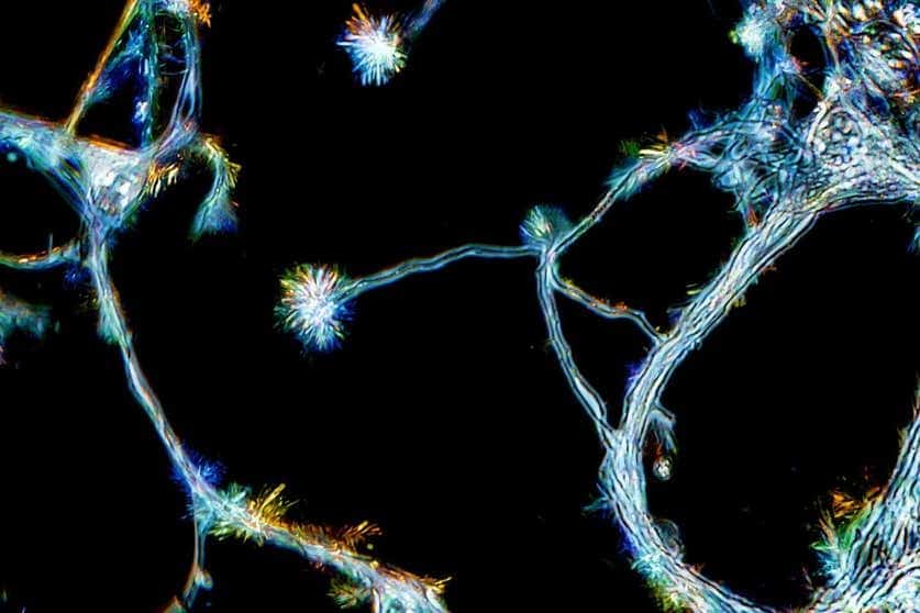 neurogenesi adulta
