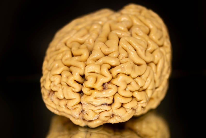Invecchiamento cognitivo