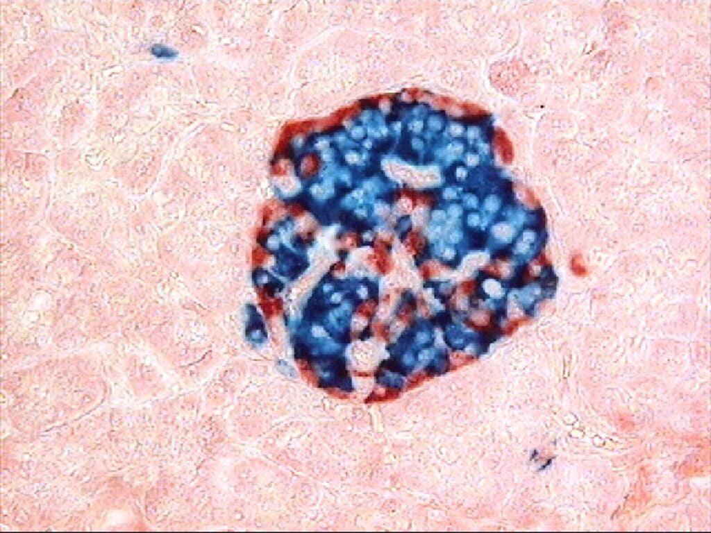 Cellule pancreatiche