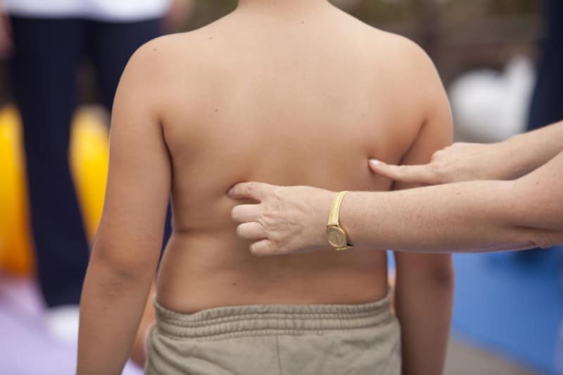 Bambini obesi