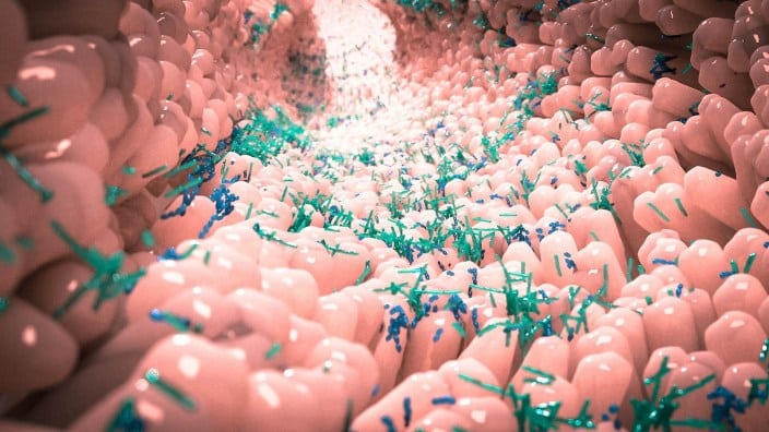 Screening colon