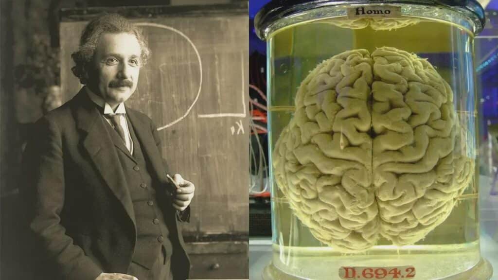 Cervello di Einstein