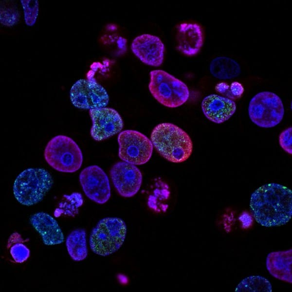 immunoma