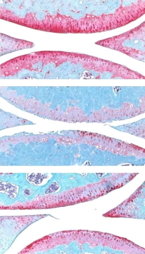 Cartilagine del ginocchio