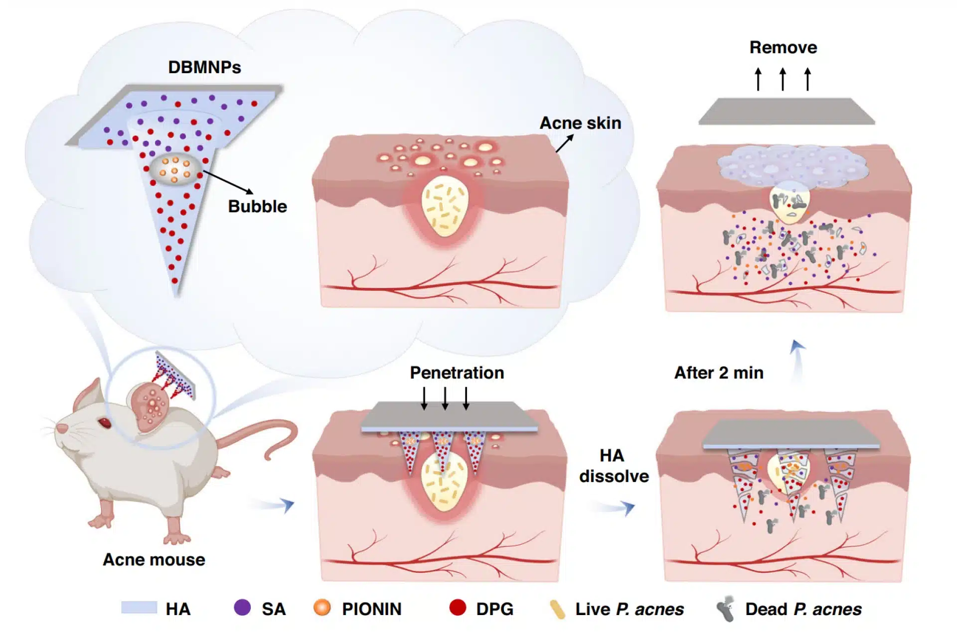 Acne cura trattamento pelle