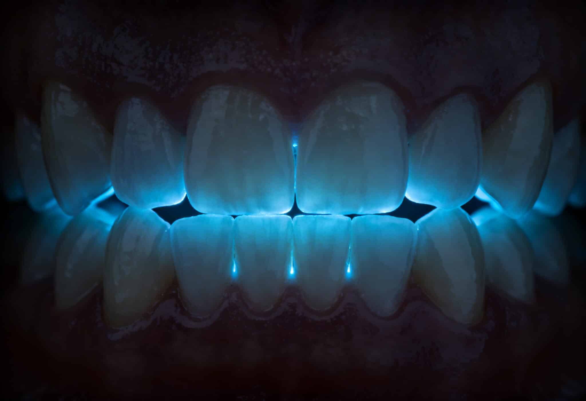 Cancro al seno, BRCA1 e gengive: il legame che nessuno notava