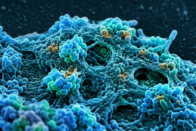 Microbioma intestinale batteri biofilm appendice umana rifugio microscopico