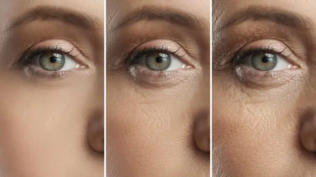 degenerazione maculare