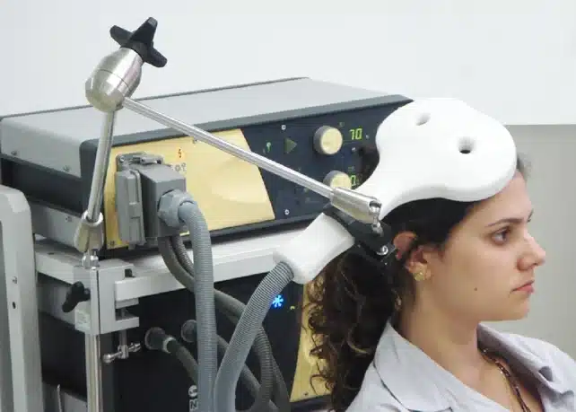 Stimolazione magnetica