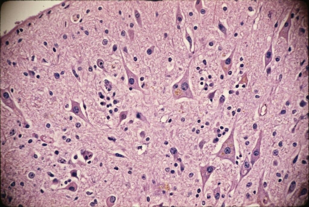 Microglia invecchiamento